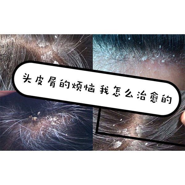 🌸快手短视频【2024新澳门正版免费资料】-大田西瓜的种植方法  第1张