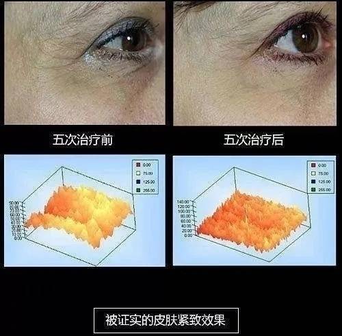 🌸飞猪视频【2024澳门资料大全免费】-朱婷或将携手日本王牌参加奥运会，加盟顶级豪门！