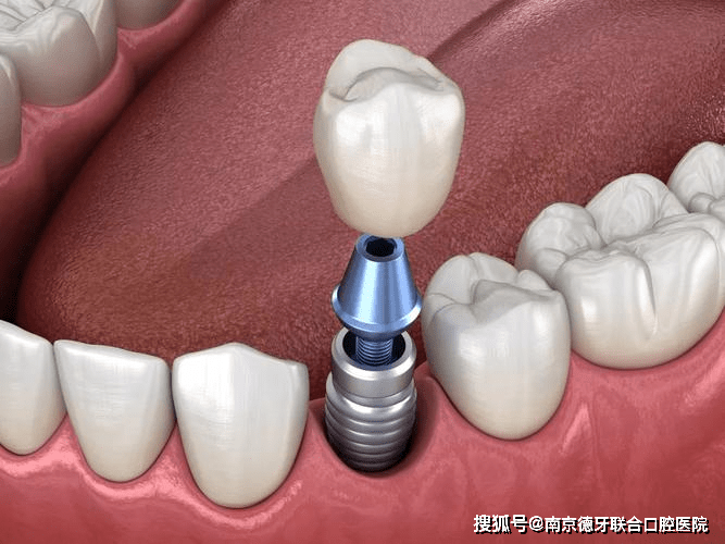 🌸龙珠直播【澳门一肖一码精准100王中王】-黄皮果怎么吃？教你吃黄皮果的方法和食用禁忌