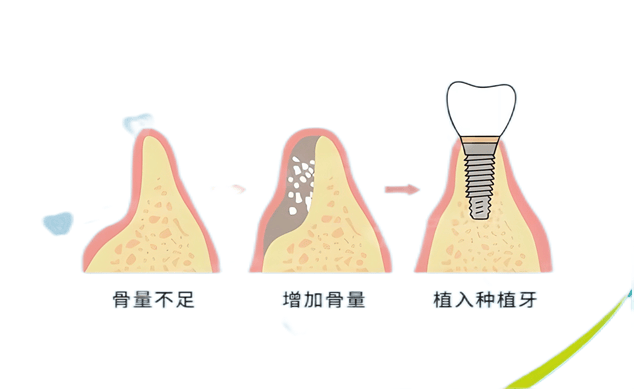 🌸芒果影视【新澳彩资料免费长期公开930期】-岁林依晨产后复出：坚守初心，拒绝家人退圈要求  第3张