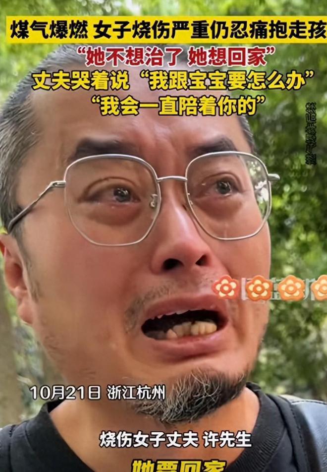 母爱力量显光辉，烧伤妈妈观孩子视频后感动落泪，生活的挑战与母爱的坚韧